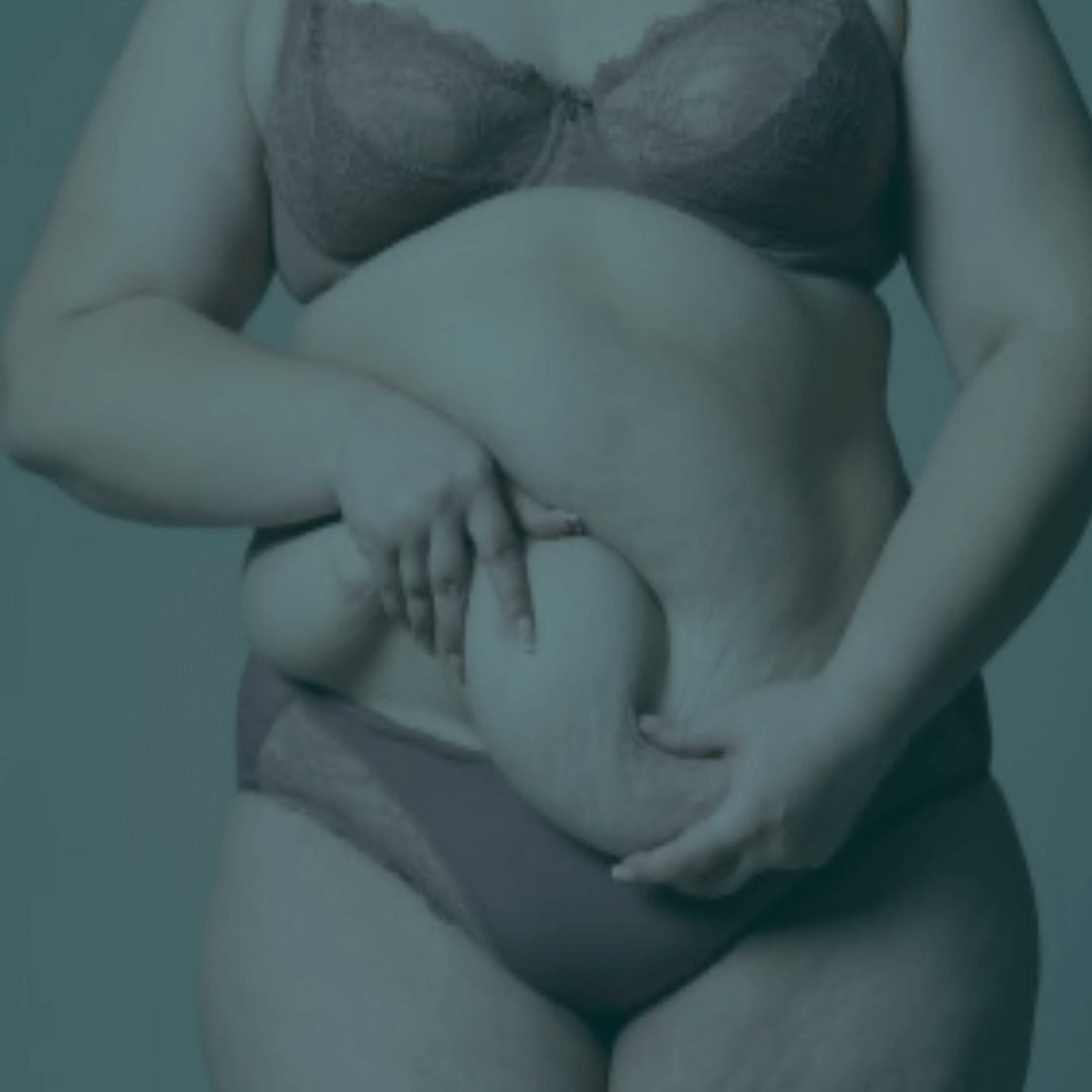 Como Conseguir Cirurgia Plástica Reparadora Pelo SUS: 